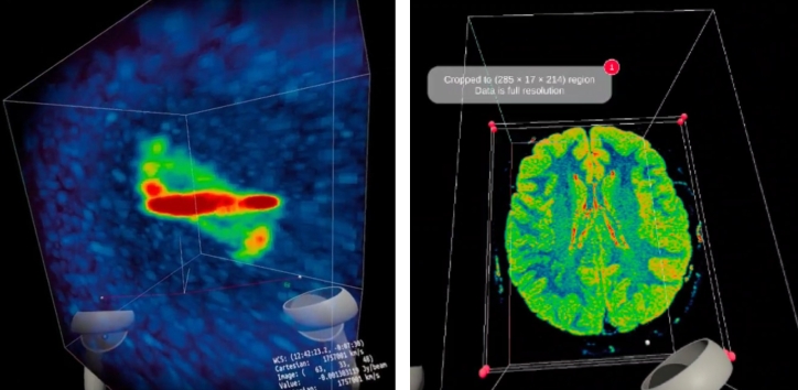 Left: the ASKAP candidate polar ring galaxy in VR. Credit: Deg et al. 2023, iDaVIE. Right: MRI of a human brain being investigated with iDaVIE. Credit: iDaVIE